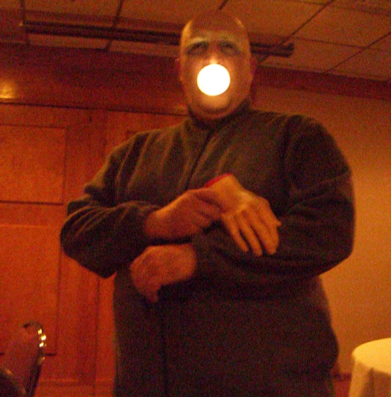 A guy with a lightbulb in his mouth, and a rubber hand